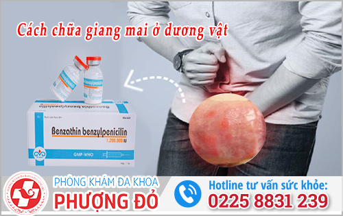 Cách chữa bệnh giang mai ở dương vật