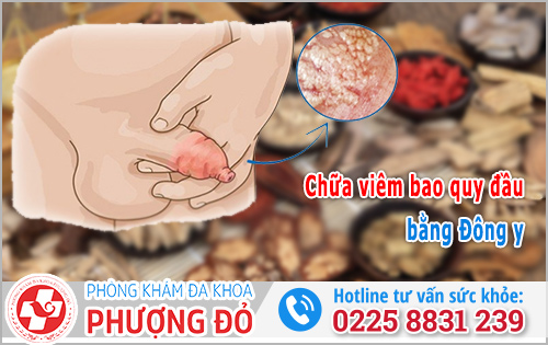 Chữa viêm bao quy đầu bằng Đông y có khỏi không?