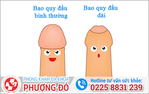 Dài bao quy đầu là gì? Để vậy có sao không?