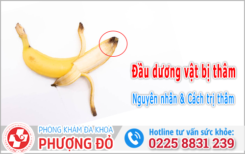 Nguyên nhân đầu dương vật bị thâm và Cách trị thâm
