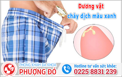 Dương vật chảy dịch màu xanh có nguy hiểm không? Là dấu hiệu bệnh gì?