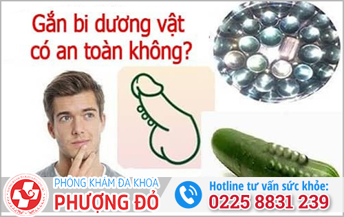 Gắn bi dương vật có an toàn không, chi phí bao nhiêu?