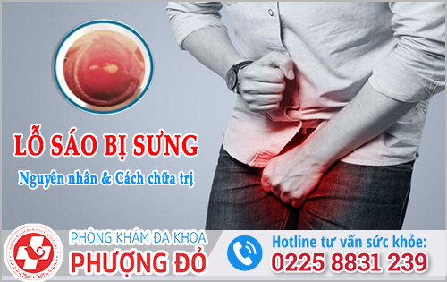 Lỗ sáo bị sưng: Nguyên nhân và Cách chữa trị