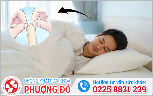 Nam giới có nên lột bao quy đầu khi ngủ? Chuyên gia giải đáp