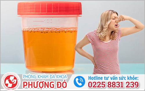 Nước Tiểu Có Mùi Hôi Là Bệnh Gì? Nguyên Nhân Và Cách Khắc Phục