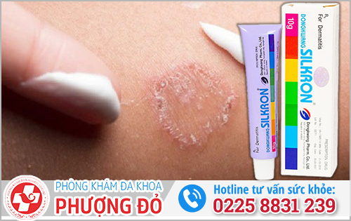 TOP 3 loại thuốc bôi đặc trị ngứa bìu an toàn, hiệu quả hiện nay