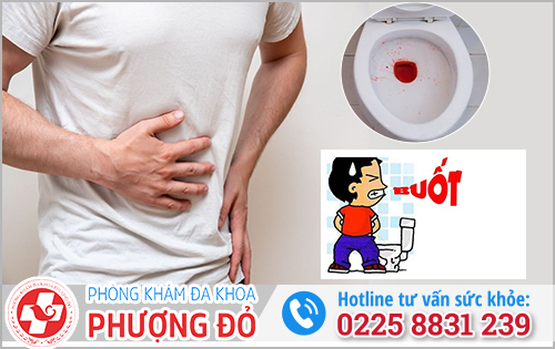 Tiểu buốt ra máu đau bụng dưới: Nguyên nhân & cách xử trí