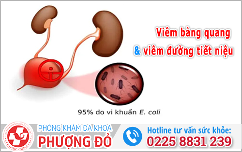 Viêm bàng quang và viêm đường tiết niệu có giống nhau không? Chuyên gia phân tích