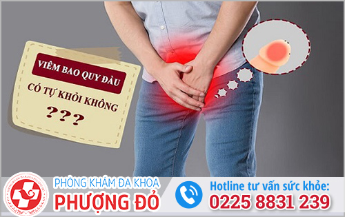 Viêm bao quy đầu có tự khỏi không? [Thông tin mới nhất]