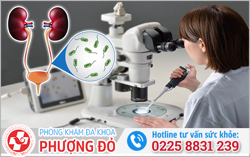 Xét nghiệm dịch niệu đạo biết được bệnh gì?