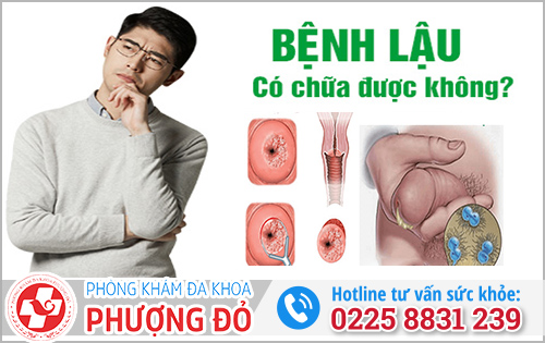 Bệnh lậu có chữa được không?