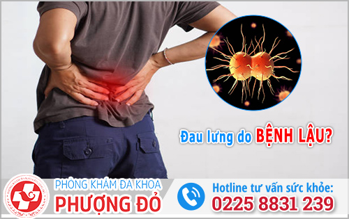 Bệnh Lậu có gây đau lưng không?
