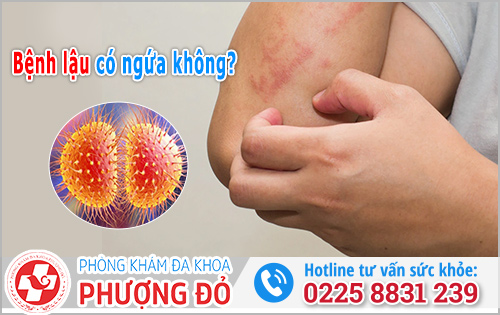 Bệnh lậu có ngứa không? 