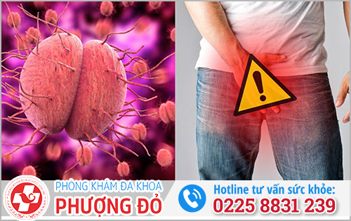 Bệnh Lậu ở nam giới