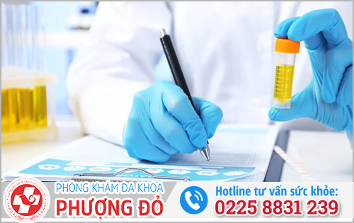 Xét nghiệm lậu bằng nước tiểu