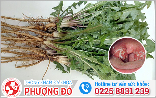 Chữa Bệnh Lậu Bằng Thuốc Đông Y