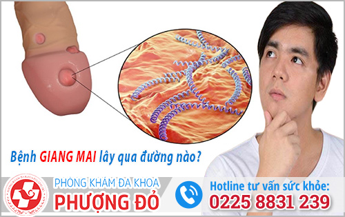 Bệnh giang mai lây qua đường nào?