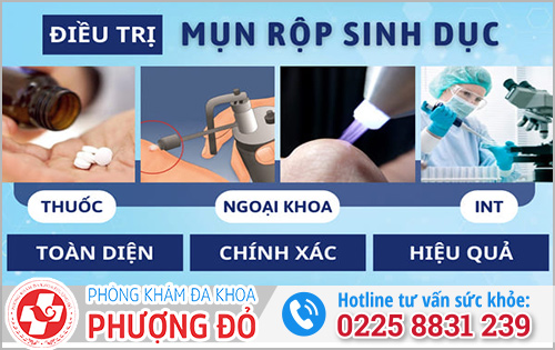 Chi phí chữa trị mụn rộp sinh dục