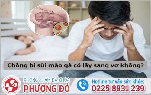 Chồng bị sùi mào gà có lây sang vợ không?