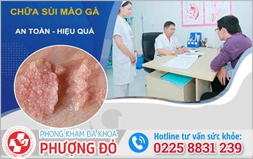 Phương pháp điều trị sùi mào gà hiện nay