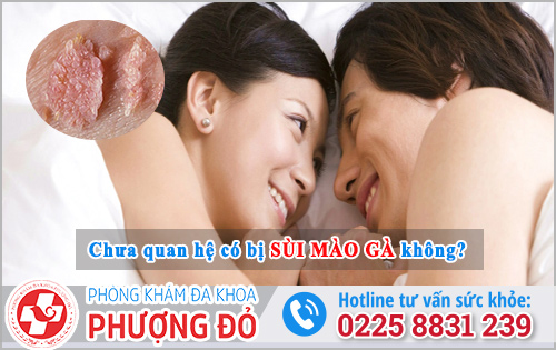 Chưa quan hệ có bị sùi mào gà không?