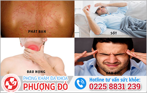 Dấu hiệu nhiễm HIV sau 2–4 tuần