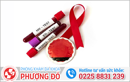 Khi nào nên xét nghiệm STD?