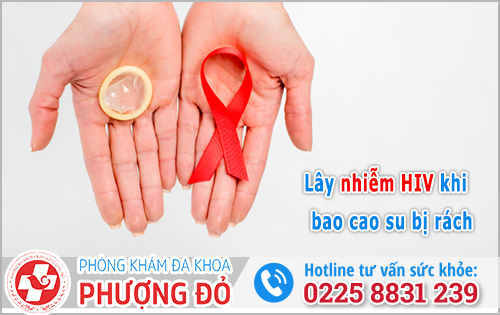 Rách bao cao su có bị lây HIV không?