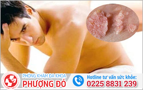 Người mắc sùi mào gà có chết được không?