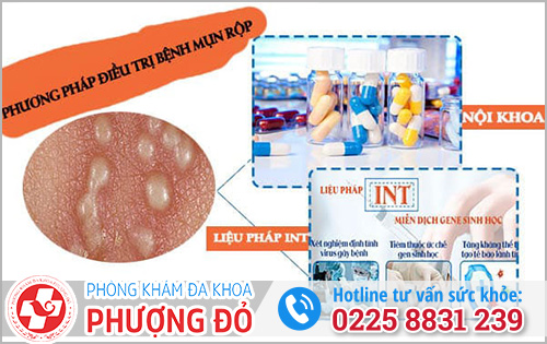 Nguyên nhân gây mụn rộp sinh dục