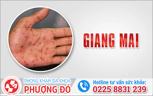 Bệnh giang mai là gì?