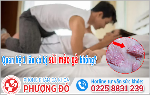Quan hệ 1 lần có bị sùi mào gà không?