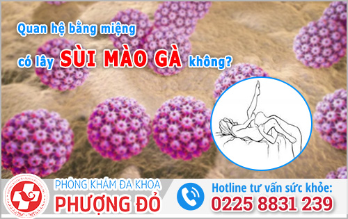 Quan hệ bằng miệng có lây bệnh sùi mào gà không?