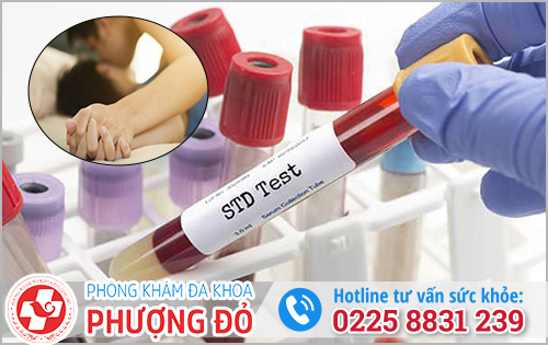 Quan hệ bao lâu có thể đi xét nghiệm các bệnh lây qua đường tình dục?