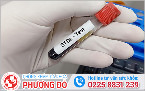 Phương pháp xét nghiệm các bệnh lây qua đường tình dục