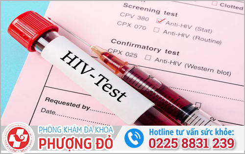 Xét nghiệm HIV