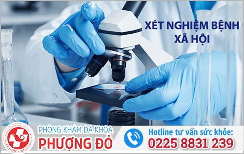 Các phương pháp xét nghiệm bệnh xã hội