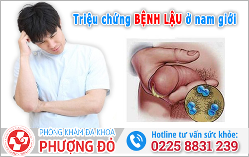 Triệu chứng bệnh lậu ở nam giới