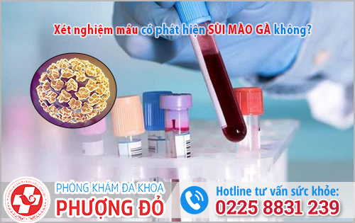 Xét nghiệm máu có phát hiện sùi mào gà không?