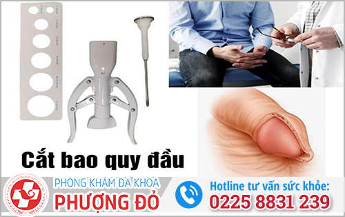 22 tuổi cắt bao quy đầu