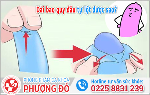 Bao quy đầu dài có lột được không? 