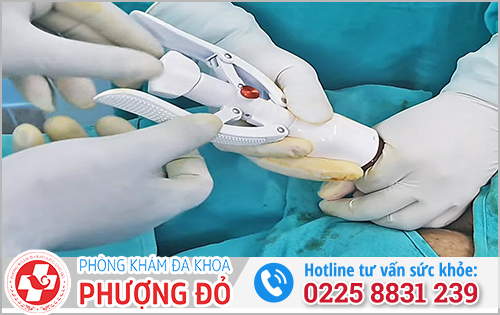 Tiêu chí chọn bệnh viện cắt bao quy đầu