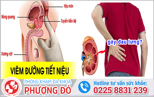 Viêm đường tiết niệu có đau lưng không?