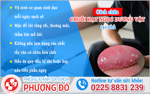 Cách chữa chuỗi hạt ngọc dương vật tại nhà