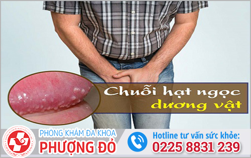 Thông tin về hạt ngọc dương vật