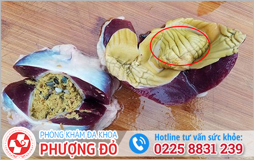 Chữa tiểu buốt ra máu tại nhà da vàng trong mề gà