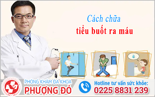 Lưu ý khi áp dụng cách chữa tiểu buốt ra máu tại nhà