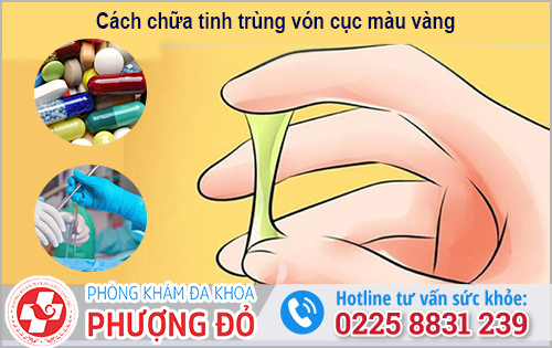 Cách chữa tinh trùng vón cục màu vàng