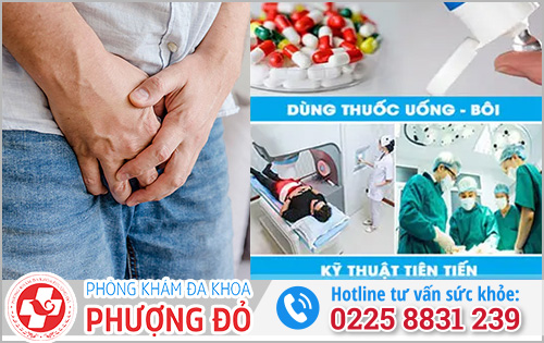 Cách trị nấm vùng kín nam