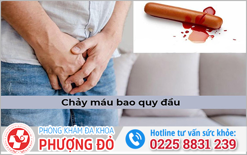 Dương vật khi mới lột bao quy đầu dễ bị chảy máu